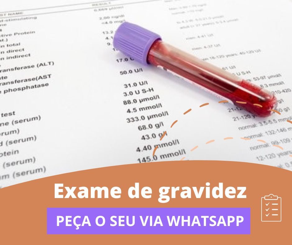 como fazer um exame de gravidez falso para imprimir